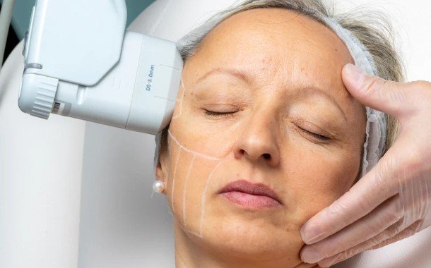 No Downtime and Minimal Discomfort